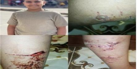 القبض على المتهم بالإعتداء على مصطاف بكلب شرس على شاطئ بورسعيد - بلس 48