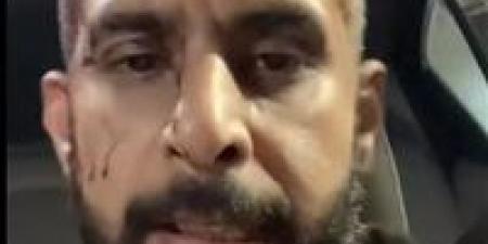 خرمولي
      جسمي..
      الأمن
      يفحص
      فيديو
      التعدي
      على
      سائق
      بالصحراوي
      في
      الجيزة - بلس 48