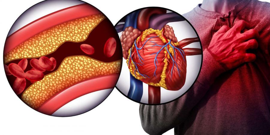 بالبلدي : هل يزيد السرطان وعلاجاته خطر الإصابة بأمراض القلب لكبار السن؟ - بلس 48