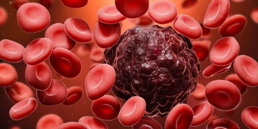 لا تتجاهلها.. أعرض خفية تنذر بالإصابة بـ اللوكيميا - بلس 48