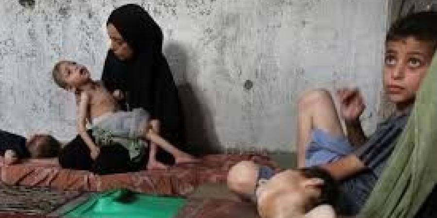5 وفيات نتيجة المجاعة وسوء التغذية في قطاع غزة خلال الـ24 ساعة الماضية - بلس 48