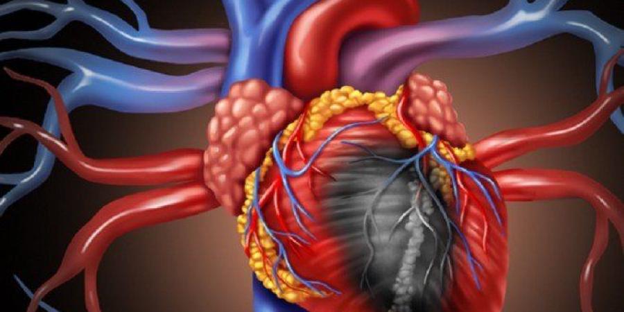احتشاء عضلة القلب.. الأعراض المبكرة وطرق الوقاية - بلس 48