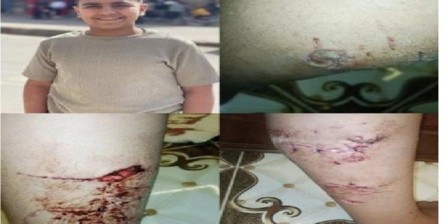 القبض على المتهم بالإعتداء على مصطاف بكلب شرس على شاطئ بورسعيد - بلس 48