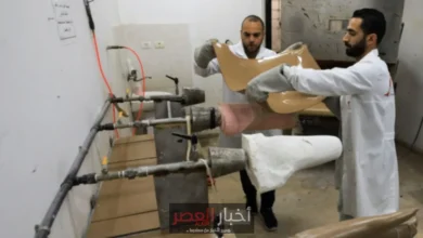 معاناة مبتوري الاطراف في غزة تتصاعد بشكل خطير وسط نقص الإمدادات وقيود الاحتلال الإسرائيلي